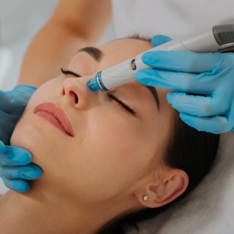 Person receiving a hydrafacial treatment with a device held by gloved hands.